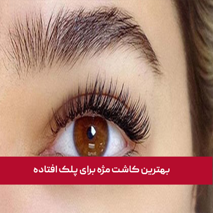 بهترین کاشت مژه برای پلک افتاده
